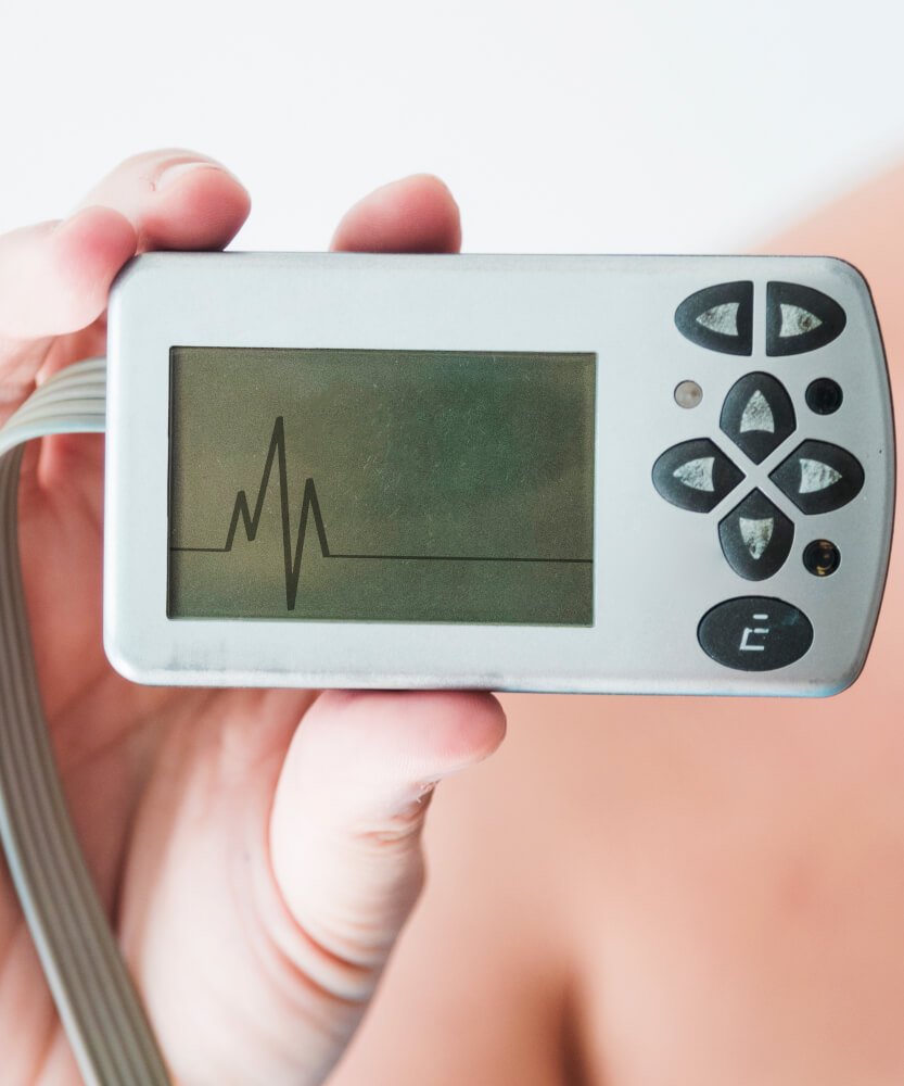 Holter 24 horas na Prezecor Holter 24 horas na Prezecor